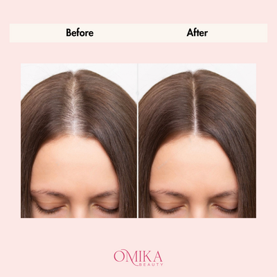 Omika Scalp Stimulating Massager™